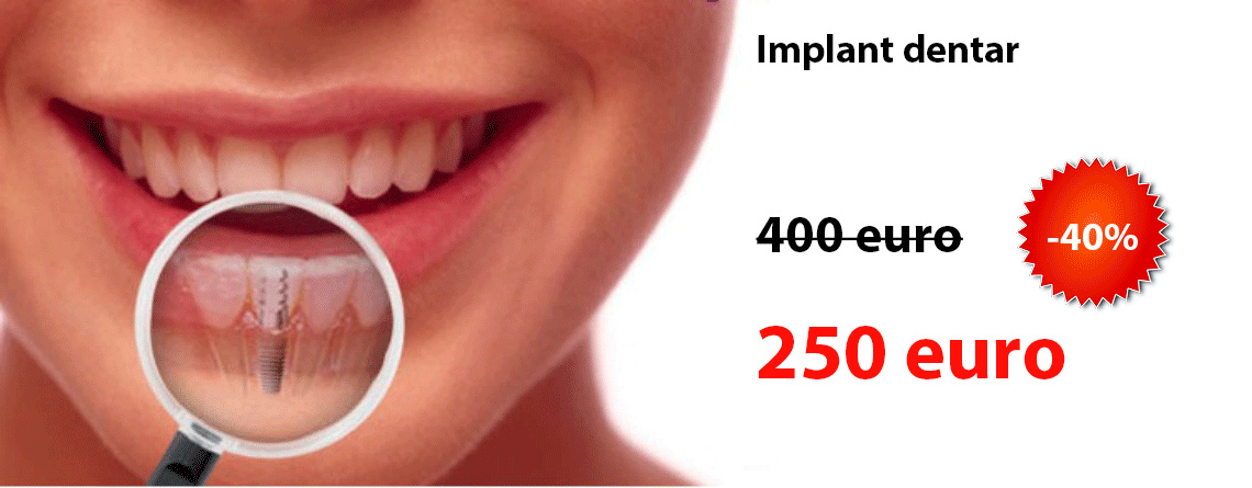 implant dentar pret Bucuresti